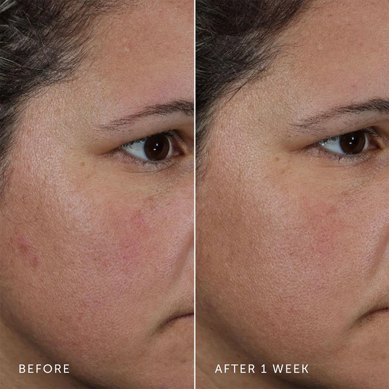 Nova Turmeric + Niacinamide Bi-Phase Glow Facial Oil